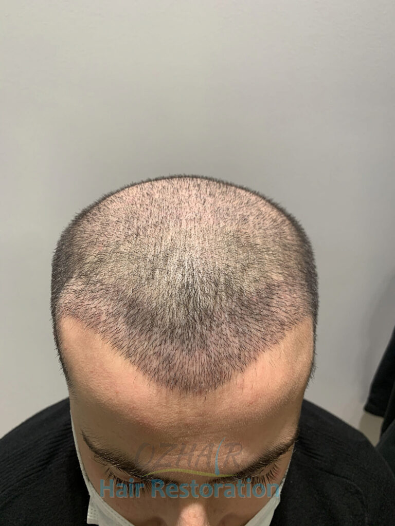 AFTER 10 DAYS