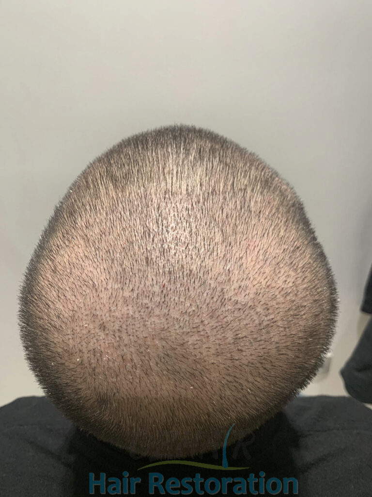 AFTER 10 DAYS