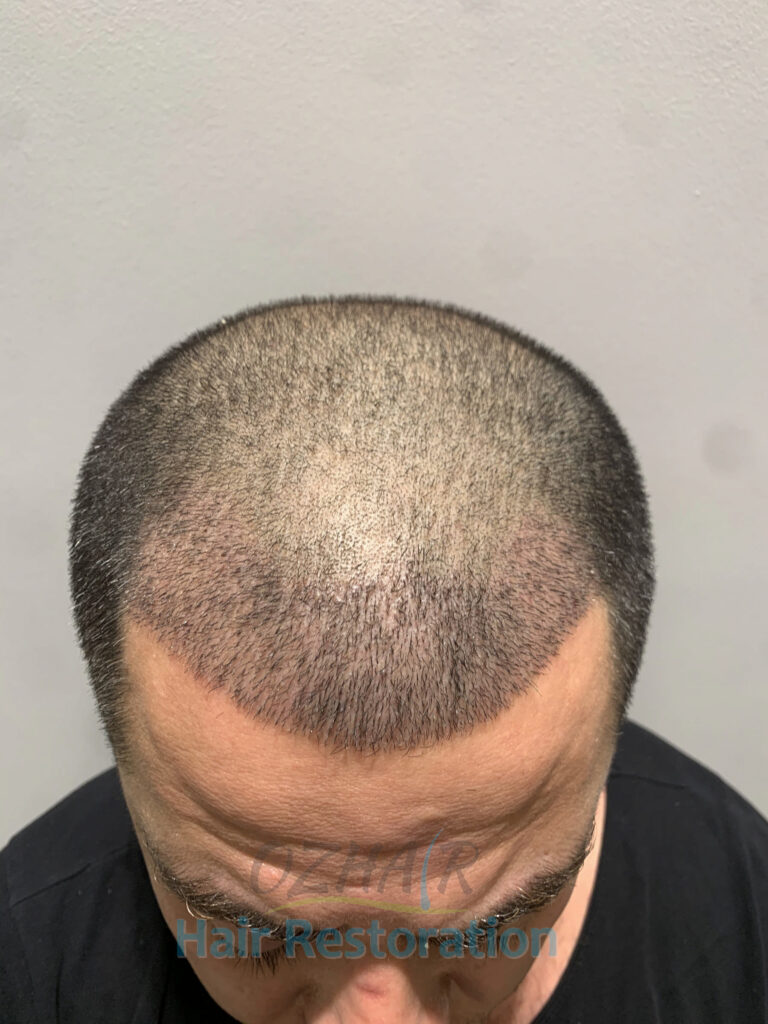 AFTER 10 DAYS