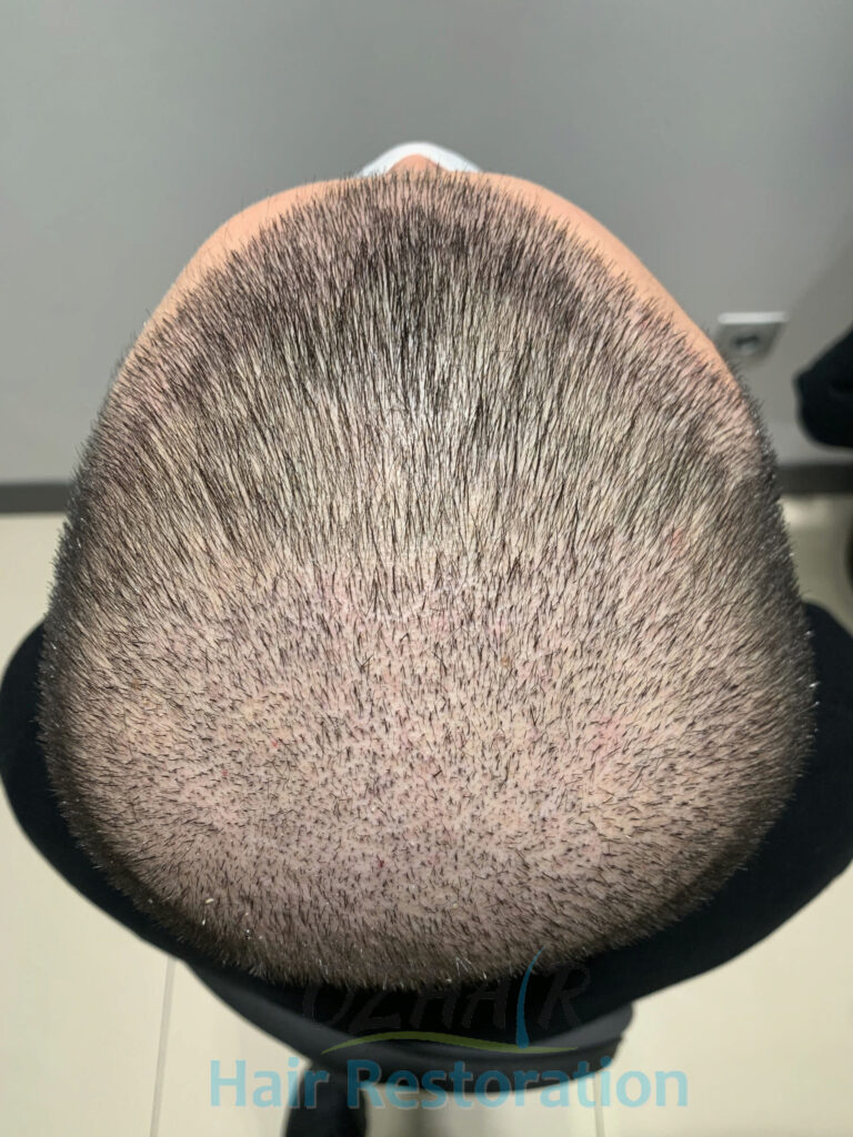 AFTER 10 DAYS