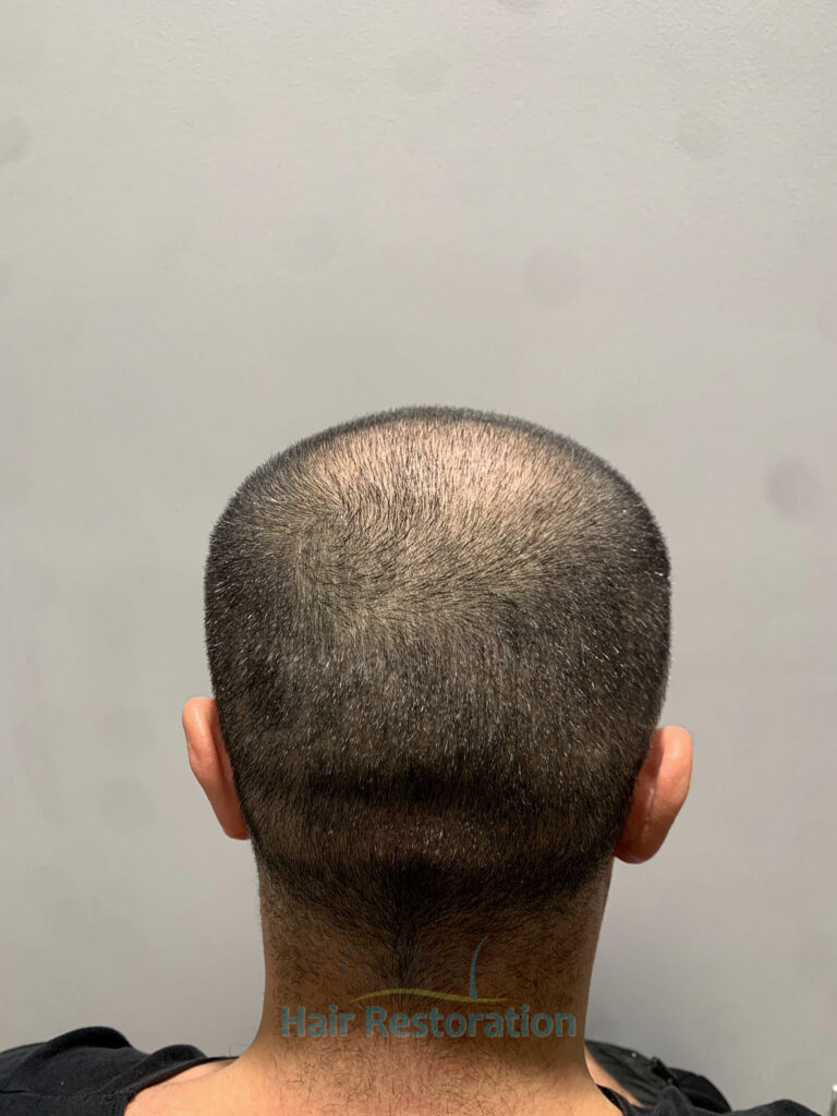 AFTER 10 DAYS