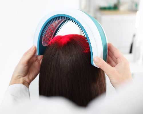 LLLT-Low-Level-Laser-Therapy-Hair-Loss